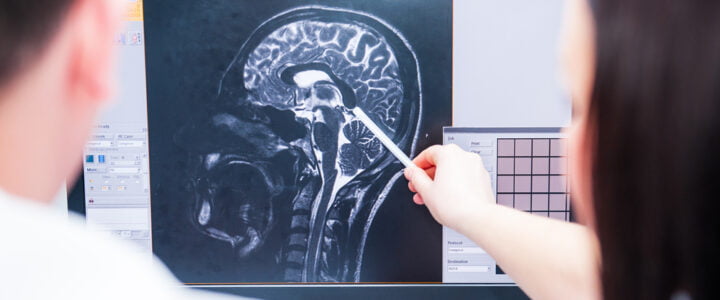 Call for evidence for people with acquired brain injuries