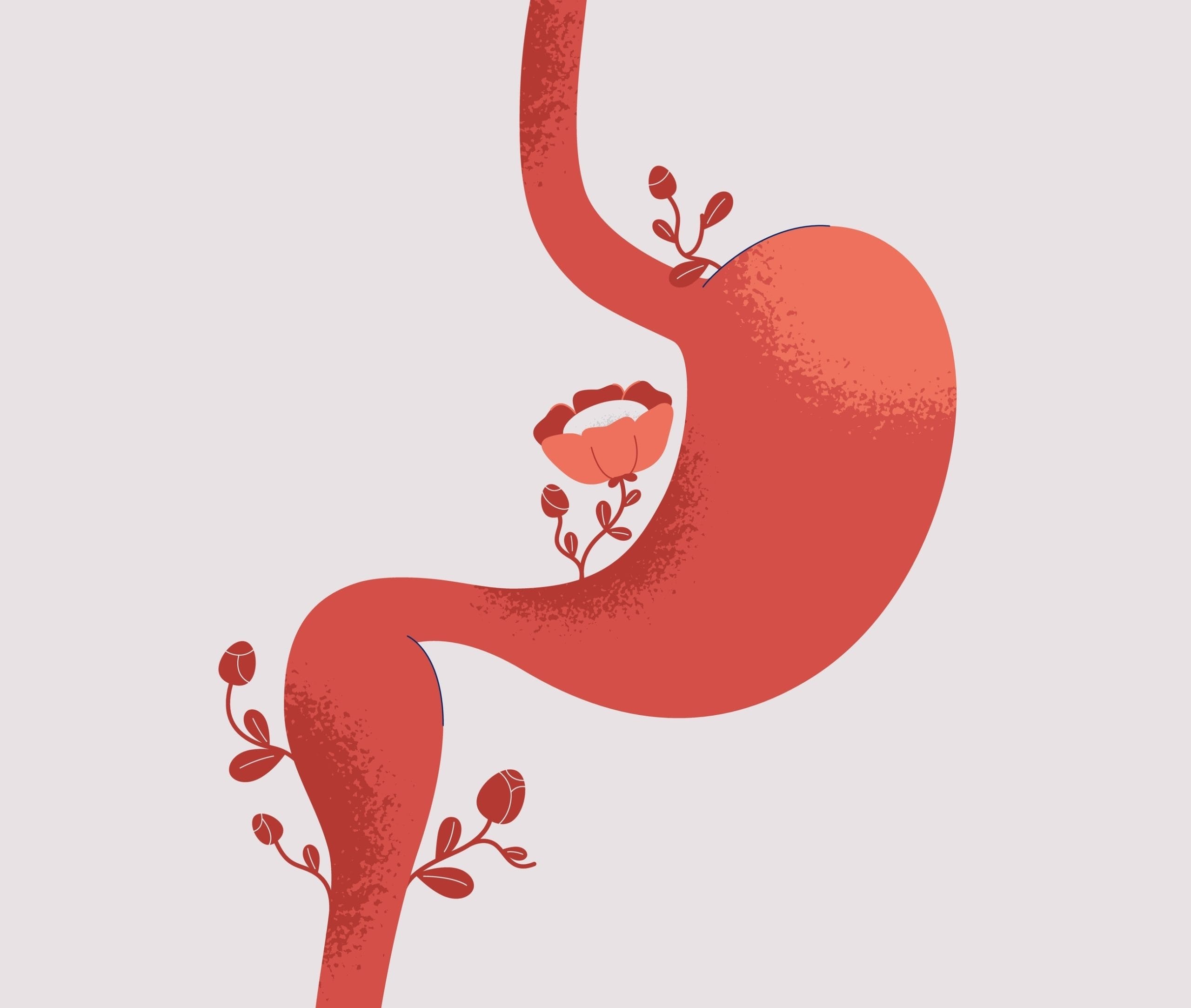Implementing NGT, PEG, and gastrostomy management in complex care